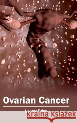 Ovarian Cancer Lester Price 9781632413123 Hayle Medical
