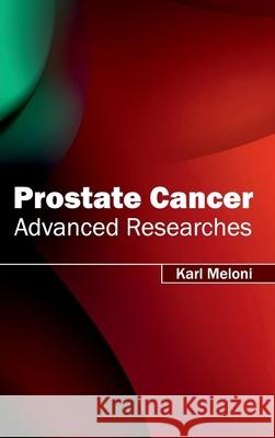 Prostate Cancer: Advanced Researches Karl Meloni 9781632413291 Hayle Medical
