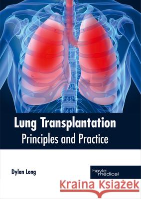 Lung Transplantation: Principles and Practice Dylan Long 9781632414335 Hayle Medical