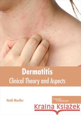 Dermatitis: Clinical Theory and Aspects Heidi Mueller 9781632414489 Hayle Medical