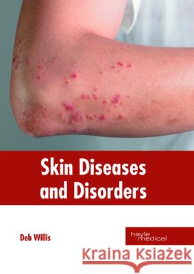 Skin Diseases and Disorders Deb Willis 9781632415189 Hayle Medical