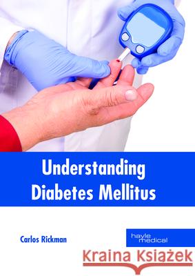 Understanding Diabetes Mellitus Carlos Rickman 9781632415233