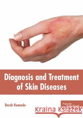 Diagnosis and Treatment of Skin Diseases Derek Kennedy 9781632415752