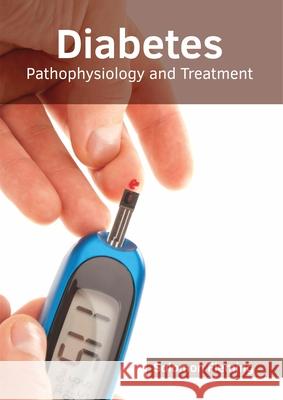 Diabetes: Pathophysiology and Treatment Solomon Fleming 9781632416032 Hayle Medical