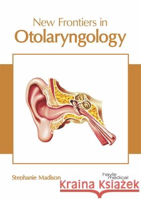 New Frontiers in Otolaryngology Stephanie Madison 9781632417251