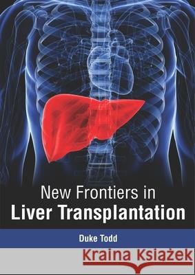 New Frontiers in Liver Transplantation Duke Todd 9781632417640 Hayle Medical