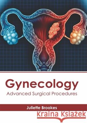 Gynecology: Advanced Surgical Procedures Juliette Brookes 9781632417657 Hayle Medical