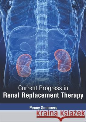 Current Progress in Renal Replacement Therapy Penny Summers 9781632417749 Hayle Medical