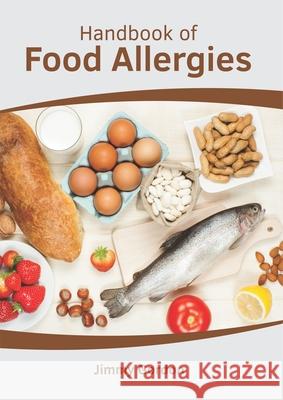 Handbook of Food Allergies Jimmy Gordon 9781632418128 Hayle Medical