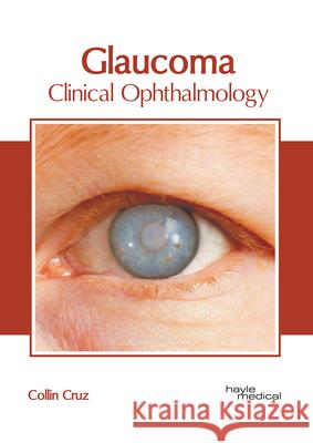 Glaucoma: Clinical Ophthalmology Collin Cruz 9781632418975 Hayle Medical
