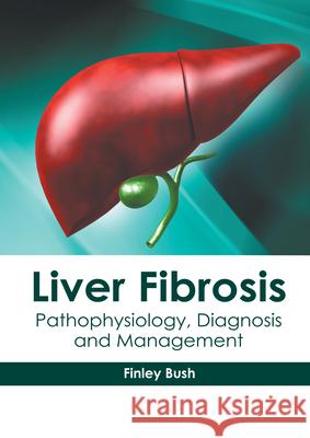 Liver Fibrosis: Pathophysiology, Diagnosis and Management Finley Bush 9781632419101 Hayle Medical