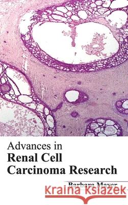 Advances in Renal Cell Carcinoma Research Barbara Mayer 9781632420367 Foster Academics