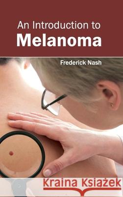 Introduction to Melanoma Frederick Nash 9781632420459