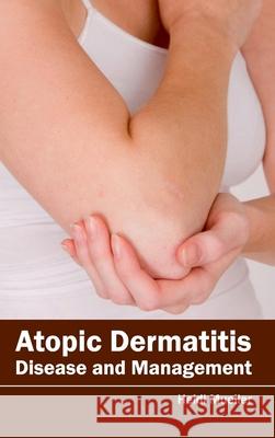 Atopic Dermatitis: Disease and Management Heidi Mueller 9781632420589 Foster Academics