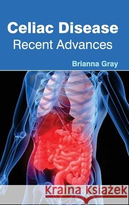 Celiac Disease: Recent Advances Brianna Gray 9781632420732 Foster Academics