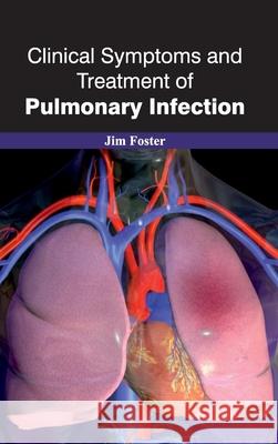 Clinical Symptoms and Treatment of Pulmonary Infection Jim Foster 9781632420862 Foster Academics