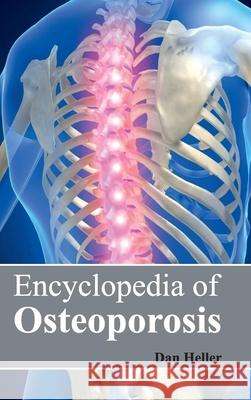 Encyclopedia of Osteoporosis Dan Heller 9781632421692 Foster Academics