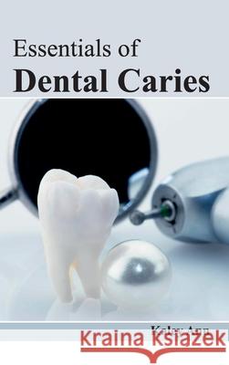 Essentials of Dental Caries Kaley Ann 9781632421869 Foster Academics