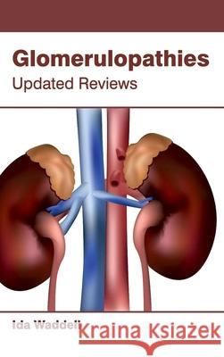 Glomerulopathies: Updated Reviews Ida Waddell 9781632421999 Foster Academics