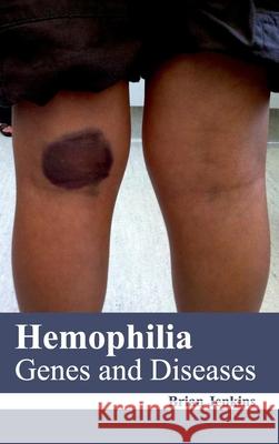 Hemophilia: Genes and Diseases Brian Jenkins 9781632422279 Foster Academics