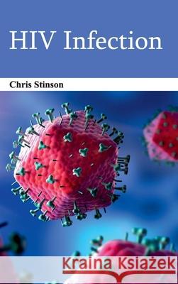 HIV Infection Chris Stinson 9781632422309 Foster Academics