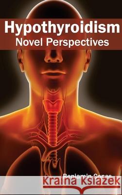 Hypothyroidism: Novel Perspectives Benjamin Copes 9781632422392 Foster Academics