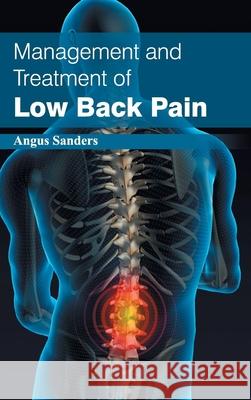 Management and Treatment of Low Back Pain Angus Sanders 9781632422682 Foster Academics