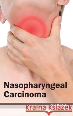 Nasopharyngeal Carcinoma Ed Welch 9781632422842 Foster Academics