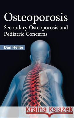 Osteoporosis: Secondary Osteoporosis and Pediatric Concerns Dan Heller 9781632423061 Foster Academics