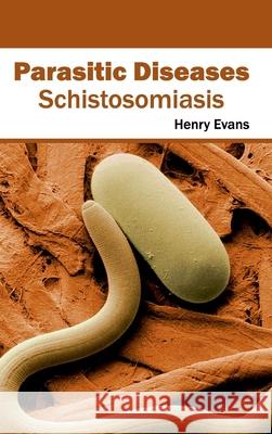 Parasitic Diseases: Schistosomiasis Henry Evans 9781632423115 Foster Academics