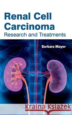 Renal Cell Carcinoma: Research and Treatments Barbara Mayer 9781632423566 Foster Academics