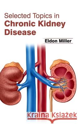 Selected Topics in Chronic Kidney Disease Eldon Miller 9781632423634