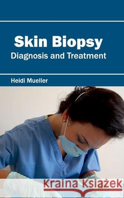 Skin Biopsy: Diagnosis and Treatment Heidi Mueller 9781632423740 Foster Academics