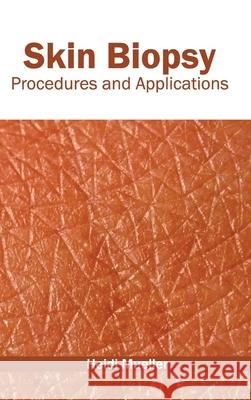 Skin Biopsy: Procedures and Applications Heidi Mueller 9781632423757 Foster Academics