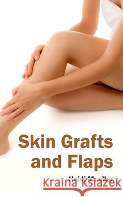 Skin Grafts and Flaps Heidi Mueller 9781632423771 Foster Academics