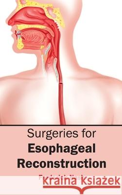 Surgeries for Esophageal Reconstruction Frederick Nash 9781632423832