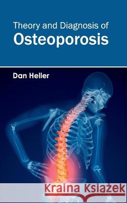 Theory and Diagnosis of Osteoporosis Dan Heller 9781632423993 Foster Academics