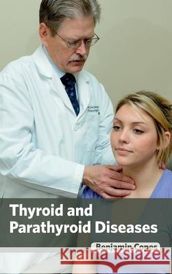 Thyroid and Parathyroid Diseases Benjamin Copes 9781632424037 Foster Academics