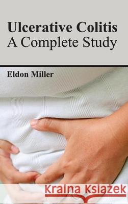 Ulcerative Colitis: A Complete Study Eldon Miller 9781632424136