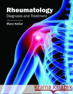 Rheumatology: Diagnosis and Treatment Mary Kellar 9781632424372 Foster Academics