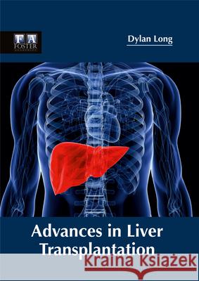 Advances in Liver Transplantation Dylan Long 9781632424730 Foster Academics