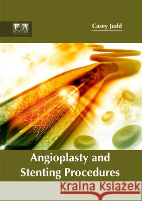 Angioplasty and Stenting Procedures Casey Judd 9781632424761 Foster Academics