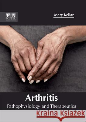 Arthritis: Pathophysiology and Therapeutics Mary Kellar 9781632424860 Foster Academics