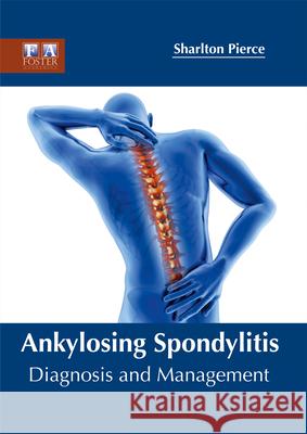 Ankylosing Spondylitis: Diagnosis and Management Sharlton Pierce 9781632424891 Foster Academics