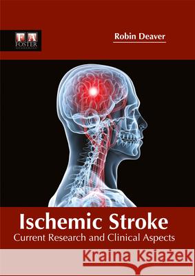 Ischemic Stroke: Current Research and Clinical Aspects Robin Deaver 9781632424952 Foster Academics