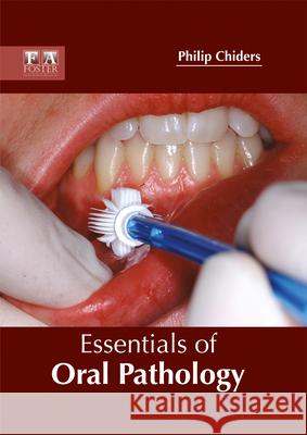 Essentials of Oral Pathology Philip Chiders 9781632424983 Foster Academics