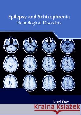 Epilepsy and Schizophrenia: Neurological Disorders Noel Day 9781632425416 Foster Academics