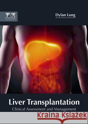 Liver Transplantation: Clinical Assessment and Management Dylan Long 9781632425539 Foster Academics