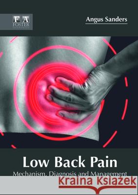 Low Back Pain: Mechanism, Diagnosis and Management Angus Sanders 9781632425546 Foster Academics