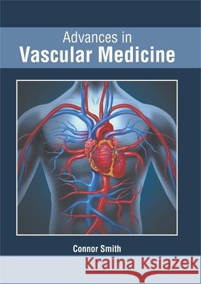 Advances in Vascular Medicine Connor Smith 9781632426000 Foster Academics